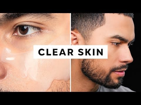 How To Get Clear Skin (Only 3 Steps)